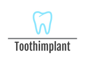 Toothimplants