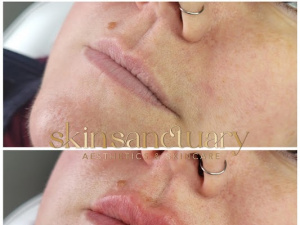 Skin Sanctuary Aesthetics & Skincare