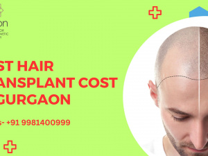 Best Hair Transplant Cost in Gurgaon