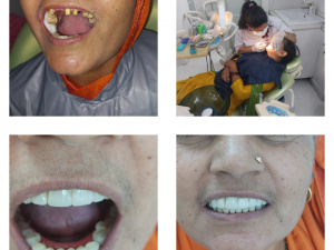 best dental clinic in rohini