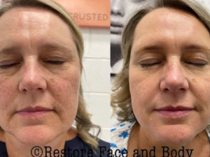 Restore Face and Body