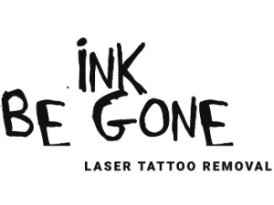 Ink Be Gone Laser Tattoo Removal