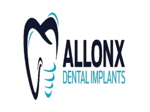 all On X Dental Implants