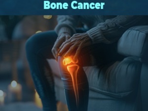 Best Bone Cancer ...