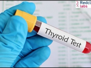 What is a thyroid profile-free test?