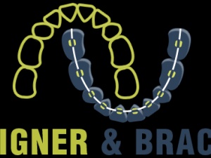 Dr. Varun Grover (Aligner & Braces)