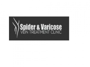 Spider and Varicose Vein Treatment Clinic