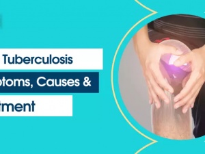 Everything Need to Know About Knee Tuberculosis