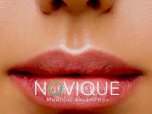 Novique Medical Aesthetics