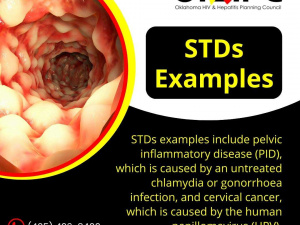 stds examples