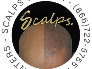 SCALPS | Scalp Micropigmentation Centers